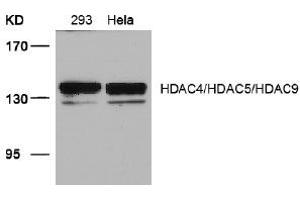 Image no. 3 for anti-HDAC4,HDAC5,HDAC9 (Ser220), (Ser246), (Ser259) antibody (ABIN319390) (HDAC4/HDAC5/HDAC9 anticorps  (Ser220, Ser246, Ser259))