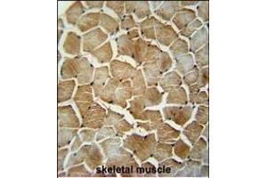 MRM1 antibody (N-term) (ABIN654341 and ABIN2844111) immunohistochemistry analysis in formalin fixed and paraffin embedded human skeletal muscle followed by peroxidase conjugation of the secondary antibody and DAB staining.