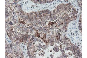 Image no. 5 for anti-SUMO1/sentrin/SMT3 Specific Peptidase 2 (SENP2) (AA 139-523) antibody (ABIN1490927)