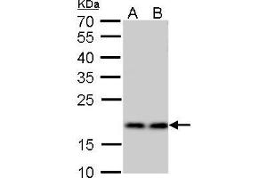 WB Image RPS15 antibody detects RPS15 protein by Western blot analysis.