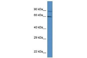 Western Blot showing MUS81 antibody used at a concentration of 1 ug/ml against Jurkat Cell Lysate (MUS81 anticorps  (Middle Region))
