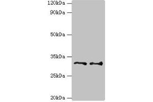 Western blot All lanes: Tumor necrosis factor receptor superfamily member 27 antibody at 6 μg/mL Lane 1: HepG2 whole cell lysate Lane 2: Hela whole cell lysate Secondary Goat polyclonal to rabbit IgG at 1/10000 dilution Predicted band size: 33, 36 kDa Observed band size: 33 kDa (Ectodysplasin A2 Receptor anticorps  (AA 1-138))