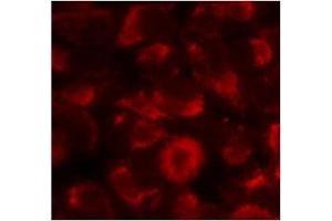 Image no. 2 for anti-Heat Shock Protein 90kDa alpha (Cytosolic), Class B Member 1 (HSP90AB1) (Ser254) antibody (ABIN197569) (HSP90AB1 anticorps  (Ser254))