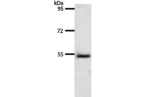 Western Blot analysis of Human liver cancer tissue using A1BG Polyclonal Antibody at dilution of 1:500 (A1BG anticorps)