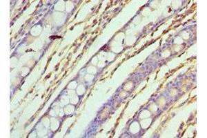 Immunohistochemistry of paraffin-embedded human colon tissue using ABIN7155295 at dilution of 1:100