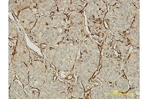 anti-Platelet/endothelial Cell Adhesion Molecule (PECAM1) (AA 29-738) antibody