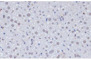 Immunohistochemistry of paraffin-embedded Rat liver using PCNA Polyclonal Antibody at dilution of 1:100 (40x lens). (PCNA anticorps)