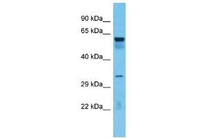 Host:  Rabbit  Target Name:  TOX4  Sample Type:  Lung tumor lysates  Antibody Dilution:  1. (TOX4 anticorps  (C-Term))