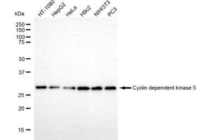 Western blotting analysis using cyclin dependent kinase 5 antibody (ABIN7798216).