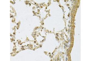 Immunohistochemistry of paraffin-embedded Rat lung using PSMA5 Polyclonal Antibody at dilution of 1:100 (40x lens). (PSMA5 anticorps)