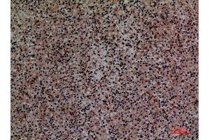 Immunohistochemistry (IHC) analysis of paraffin-embedded Human Spleen, antibody was diluted at 1:100. (SIGLEC-5,SIGLEC-14 (Internal Region) anticorps)