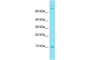 Host: Rabbit Target Name: C7orf49 Sample Type: MDA-MB-435S Whole Cell lysates Antibody Dilution: 1. (C7orf49 anticorps  (N-Term))