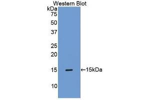 Western Blotting (WB) image for anti-TIMP Metallopeptidase Inhibitor 1 (TIMP1) (AA 35-160) antibody (ABIN1173100) (TIMP1 anticorps  (AA 35-160))