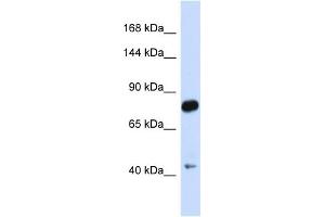 Host:  Rabbit  Target Name:  CDH23  Sample Type:  Fetal Brain lysates  Antibody Dilution:  1. (CDH23 anticorps  (N-Term))