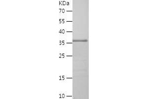 Western Blotting (WB) image for delta-Like 4 (DLL4) (AA 558-685) protein (His-IF2DI Tag) (ABIN7122629)