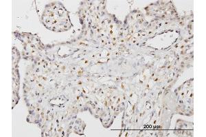 Immunoperoxidase of monoclonal antibody to STK33 on formalin-fixed paraffin-embedded human placenta. (STK33 anticorps  (AA 1-514))