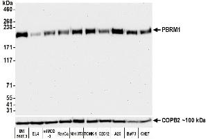 Western Blotting (WB) image for anti-Polybromo 1 (PBRM1) (AA 1-293) antibody (ABIN7454032)