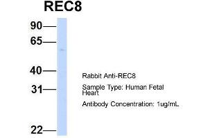 Host:  Rabbit  Target Name:  REC8  Sample Type:  Human Fetal Heart  Antibody Dilution:  1. (REC8 anticorps  (N-Term))