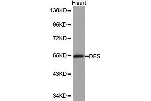 Western Blotting (WB) image for anti-Desmin (DES) (AA 121-470) antibody (ABIN3021115) (Desmin anticorps  (AA 121-470))