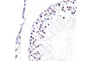 Immunohistochemistry of paraffin-embedded rat testis using H3K36me2 antibody.