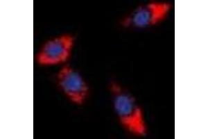 Immunofluorescent analysis of PDCD12 staining in HeLa cells. (AVEN anticorps  (C-Term))