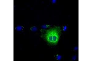 Anti-TBXAS1 mouse monoclonal antibody (ABIN2453709) immunofluorescent staining of COS7 cells transiently transfected by pCMV6-ENTRY TBXAS1 (RC208028). (TBXAS1 anticorps)