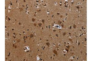 The image on the left is immunohistochemistry of paraffin-embedded Human brain tissue using ABIN7191807(PCDHB11 Antibody) at dilution 1/50, on the right is treated with synthetic peptide. (PCDHB11 anticorps)