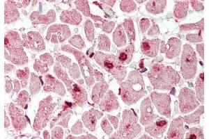 Rabbit Anti-Mxi1 antibody  Formalin Fixed Paraffin Embedded Tissue: Human Heart Primary antibody Concentration: 1:200 Secondary Antibody: Donkey anti-Rabbit-Cy3 Secondary Antibody Concentration: 1:200 Magnification: 20x Exposure Time: 0.