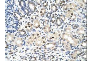 Image no. 1 for anti-Calcium Channel, Voltage-Dependent, beta 1 Subunit (CACNB1) (AA 201-250) antibody (ABIN6736600)