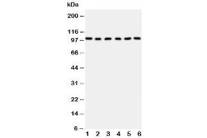 Western blot testing of MCM2 antibody and Lane 1:  rat testis