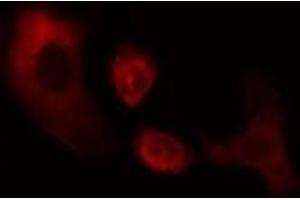 ABIN6274966 staining Hela cells by IF/ICC. (CES2 anticorps  (N-Term))