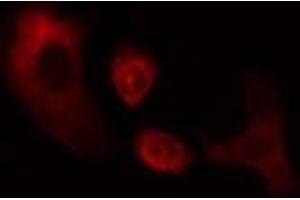 ABIN6274966 staining Hela cells by IF/ICC.