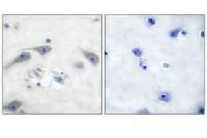 Immunohistochemical analysis of paraffin-embedded human brain tissue using DARPP-32 (Ab-75) antibody.