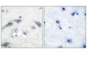 Immunohistochemical analysis of paraffin-embedded human brain tissue using DARPP-32 (Ab-75) antibody. (DARPP32 anticorps  (Thr75))
