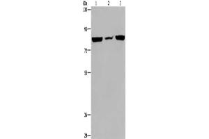 Gel: 6 % SDS-PAGE, Lysate: 40 μg, Lane 1-3: A549 cells, mouse heart tissue, Hela cells, Primary antibody: ABIN7130075(LEPREL2 Antibody) at dilution 1/300, Secondary antibody: Goat anti rabbit IgG at 1/8000 dilution, Exposure time: 20 seconds (LEPREL2 anticorps)