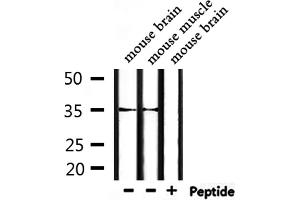 Western blot analysis of extracts from mouse brain and mouse muscle, using OR52P1 Antibody. (OR52P1 anticorps)