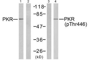 Western blot analysis of extracts from K562 cells, using PKR (Ab-446) antibody (E021272, Line 1 and 2) and PKR (phospho-Thr446) antibody (E011280, Line 3 and 4). (EIF2AK2 anticorps)