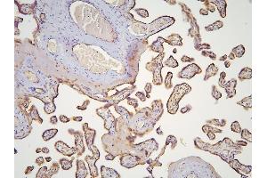 IHC analysis of HOOK3 using anti-HOOK3 antibody (ABIN6719547). (HOOK3 anticorps  (AA 14-198))