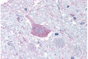 Immunohistochemical staining of human brain, medulla with MRGPRD polyclonal antibody . (MRGPRD anticorps  (Cytoplasmic Domain))