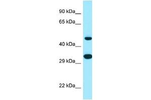 Western Blotting (WB) image for anti-Stearoyl-CoA Desaturase 5 (SCD5) (C-Term) antibody (ABIN2790026) (SCD5 anticorps  (C-Term))
