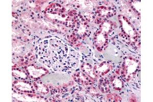 Anti-GPR91 antibody IHC of human kidney. (SUCNR1 anticorps  (C-Term))
