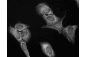 Immunofluorescence (IF) image for anti-Eukaryotic Translation Initiation Factor 4E (EIF4E) (AA 1-217) antibody (ABIN967870)