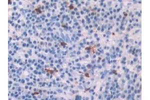 anti-Platelet Factor 4 (PF4) (AA 31-101) antibody