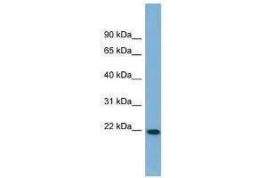 FNDC4 antibody used at 1 ug/ml to detect target protein. (FNDC4 anticorps  (Middle Region))