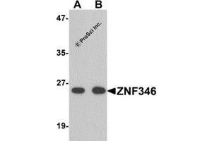 Western Blotting (WB) image for anti-Zinc Finger Protein 346 (ZNF346) (N-Term) antibody (ABIN1031685) (ZNF346 anticorps  (N-Term))