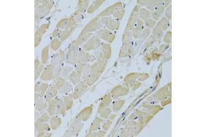 Immunohistochemistry of paraffin-embedded rat heart using CA3 Antibody (ABIN5970554) at dilution of 1/200 (40x lens). (CA3 anticorps)