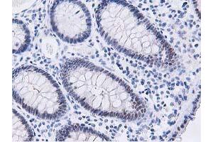Immunohistochemical staining of paraffin-embedded Human colon tissue using anti-DPP3 mouse monoclonal antibody. (DPP3 anticorps)