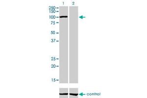 Western blot analysis of AHR over-expressed 293 cell line, cotransfected with AHR Validated Chimera RNAi (Lane 2) or non-transfected control (Lane 1). (Aryl Hydrocarbon Receptor anticorps  (AA 721-820))