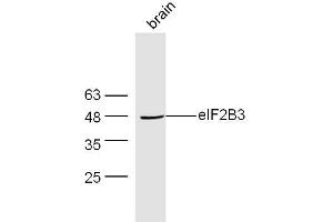 Mouse brain lysates probed with Rabbit Anti-EIF2B3 Polyclonal Antibody, Unconjugated  at 1:300 overnight at 4˚C. (EIF2B3 anticorps  (AA 101-200))