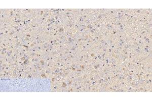 Immunohistochemistry of paraffin-embedded Mouse brain tissue using CD4 Monoclonal Antibody at dilution of 1:200. (CD4 anticorps)